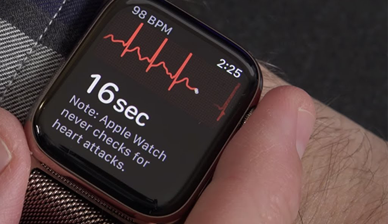 Best ECG Smartwatch